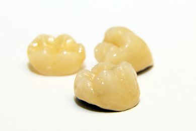 Dantų ir implantų protezavimas